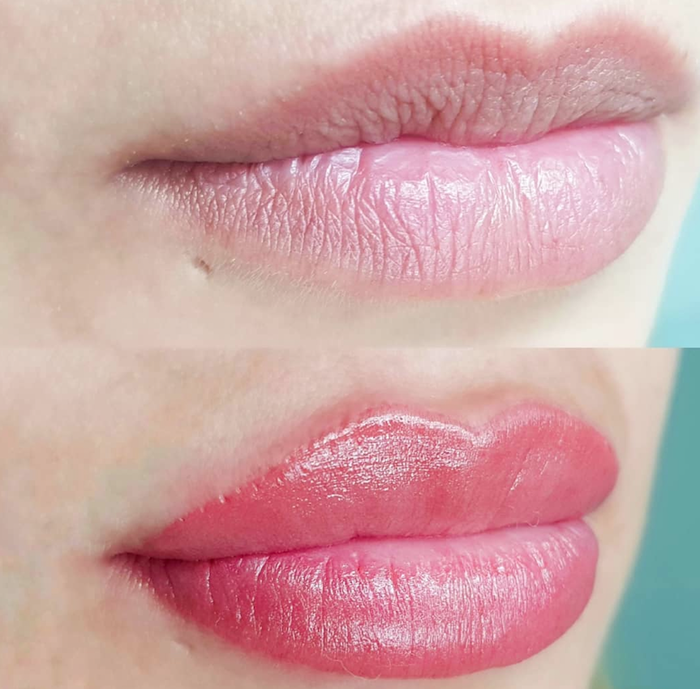 Micropigmentación De Labios