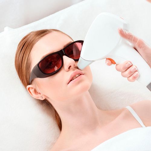 Laser De Labio Superior