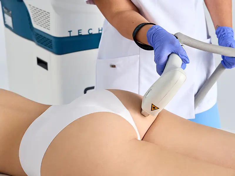 Laser De Gluteos